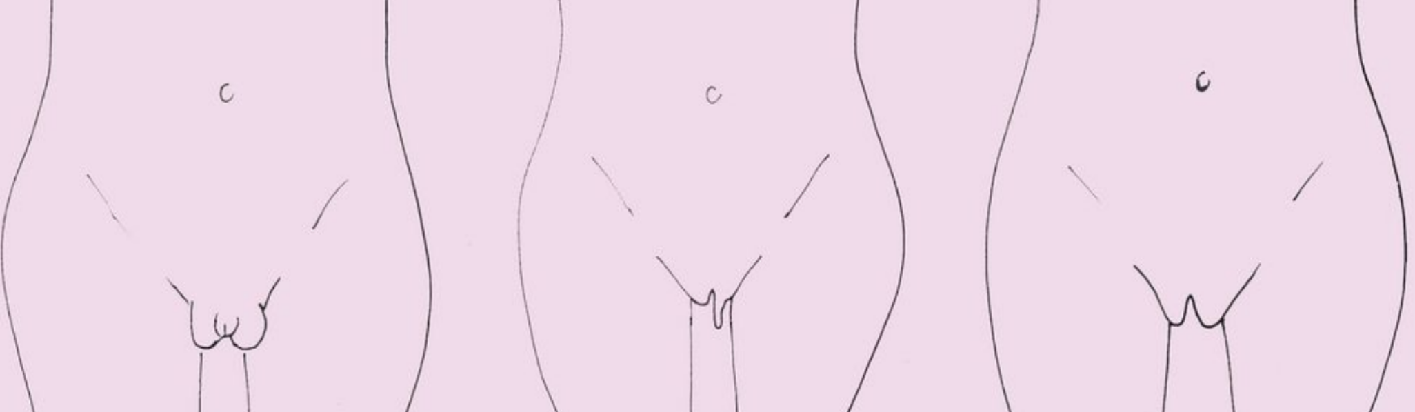 For more images and discussion check out Cosmopolitans article “These are the 7 different types of labia”