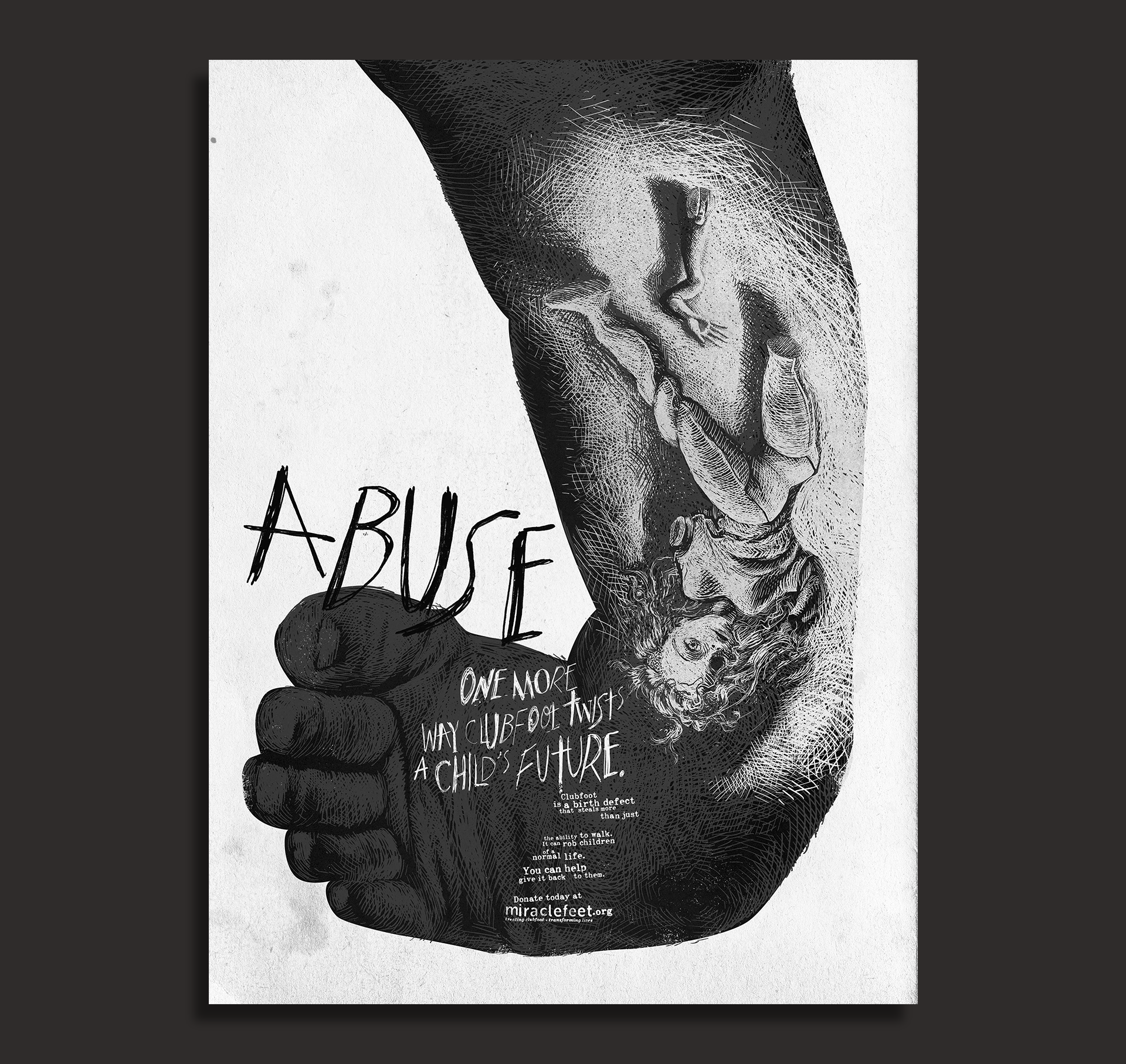 003 clubfoot abuse.png