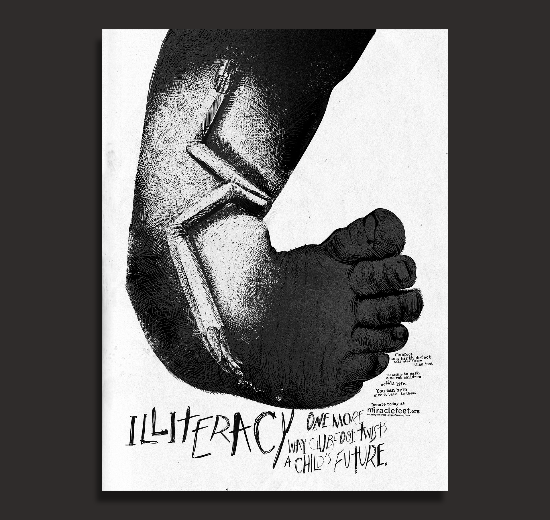005 clubfoot illiteracy.png