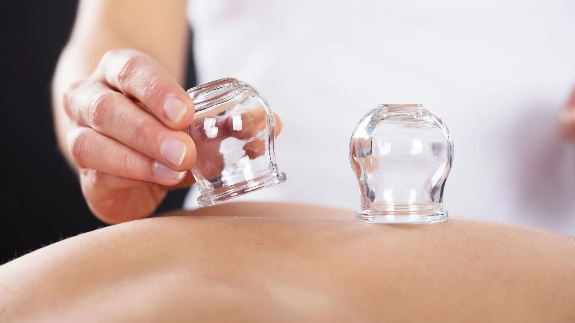 Cupping therapy for muscle tension