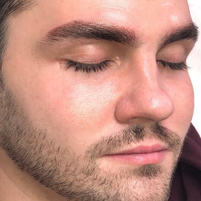 Boy brows deserve love too! Ombr&eacute;-stroke hybrid brows by @lepetitekitsune
+
#brows #ombrebrows #hybridbrows #microblading #nycbrows #browtransformation #browartist #eyebrows #beauty #eyebrows #pmu #mensgrooming  #browshaping #browsonpoint #nyc