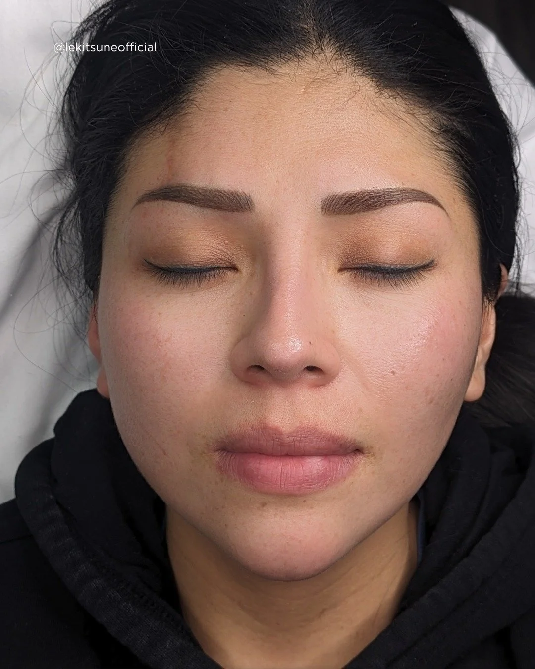 🌺 Ever imagined waking up to flawless brows and luscious lips? 💋 Explore the wonders of cosmetic tattooing at Le Kitsun&eacute;! Reserve your spot today and unlock your true beauty potential. 💫 #CosmeticTattooing #LeKitsune #PermanentMakeup #Micro