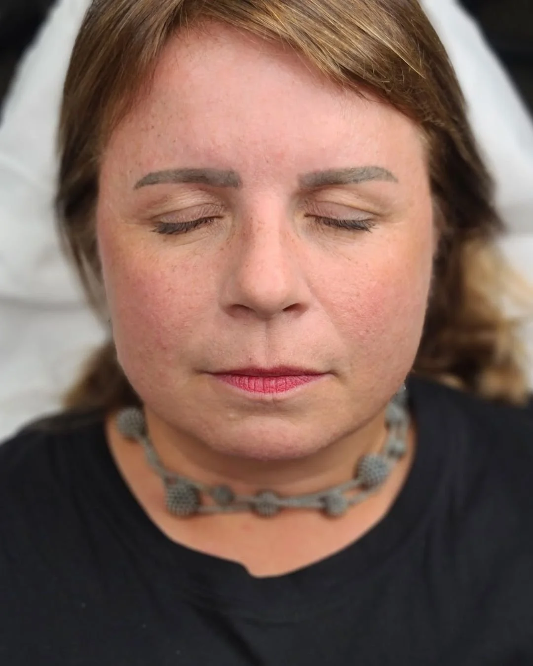 After removal session 1 heavy