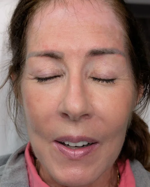 microblading brows 12 months later significant fading patchy lost definition before rebuild