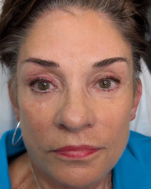 microblading brows after 6 month touch up refresh restored clarity