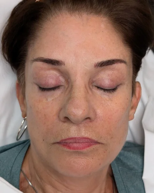 freshly healed microblading brows with crisp natural strokes after initial appointment