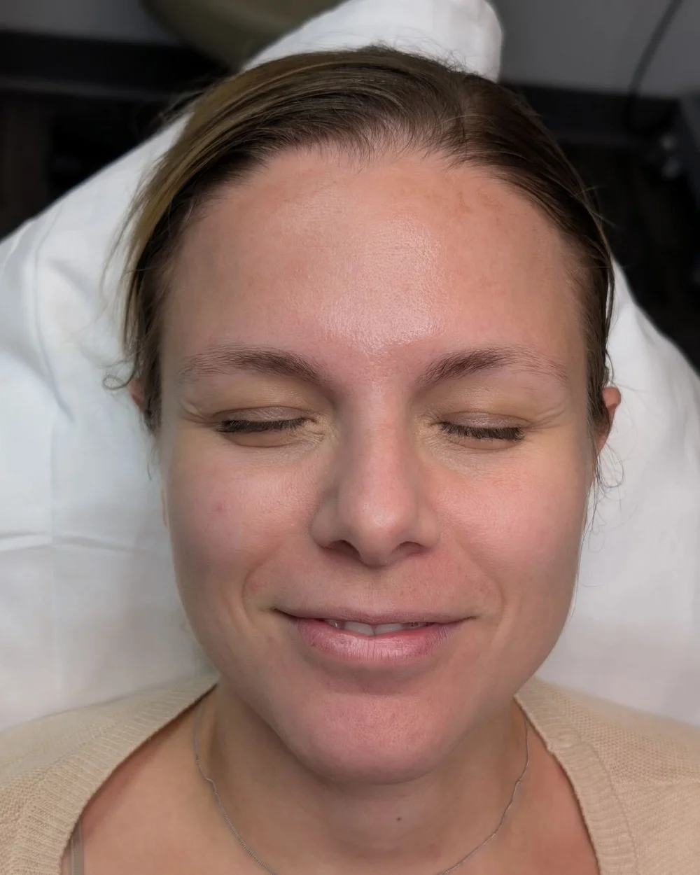 Before microblading — natural brow shape prior to treatment