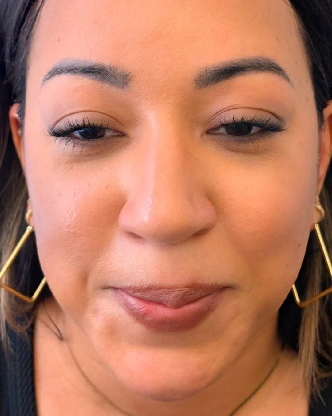 After removal session 1