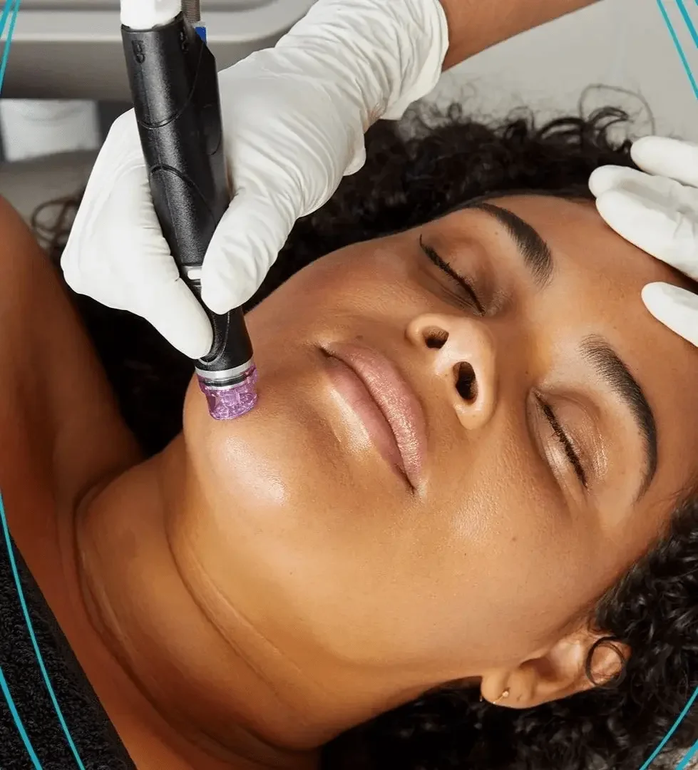 woman receiving hydrafacial at dkpESTHETICS