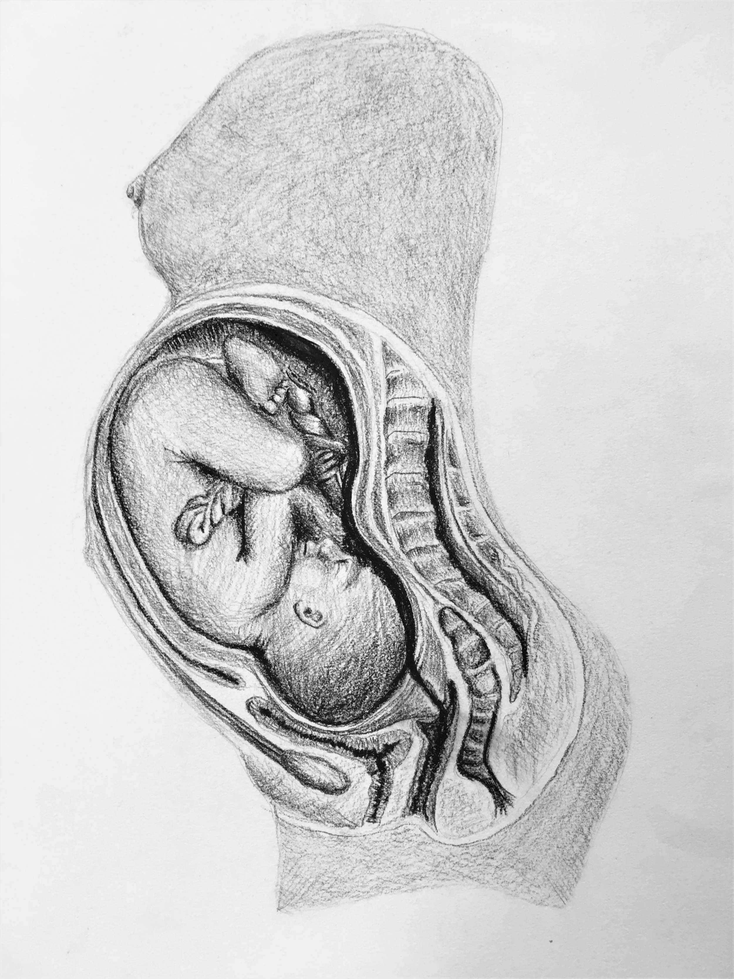 "Natural Birth" and why it's become such a dirty word