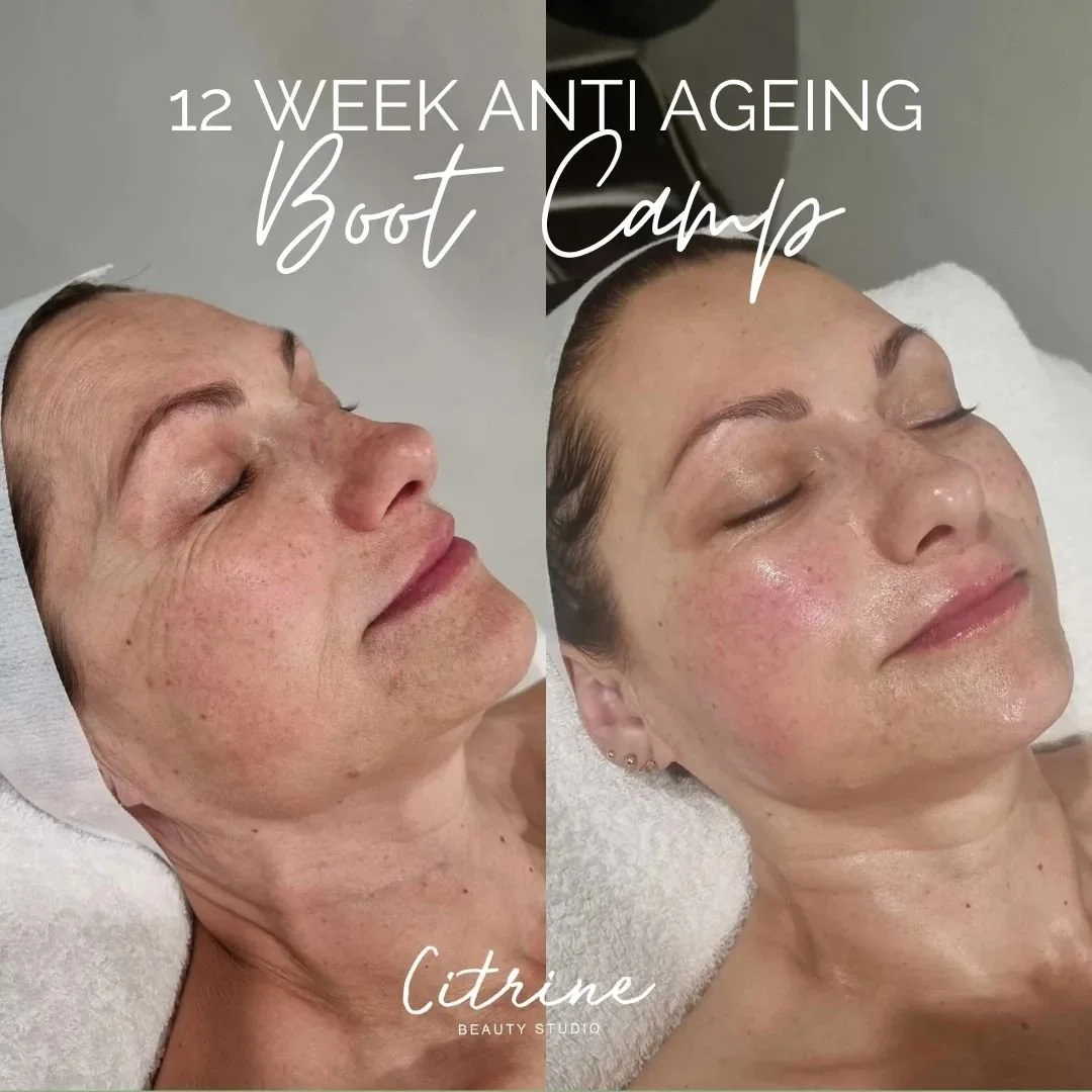 ✨️ 12 Week Anti Aging  Boot Camp ✨️
Introducing a life changing program designed to optimize your skin health and boost your confidence in as little as 12 weeks. 
Are you ready to invest in he best version of yourself? 
Simply head to our website