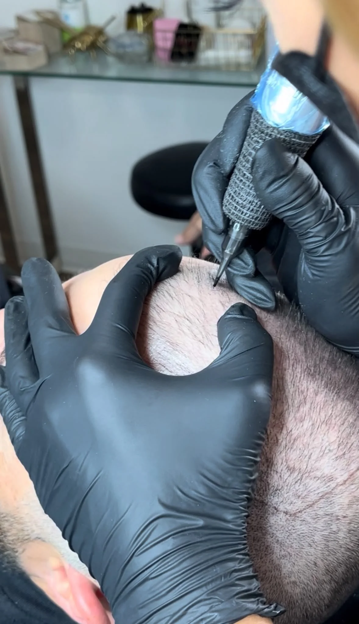 A closeup of an a permanent makeup artist wearing black gloves. She is applying scalp micropigmentation to a male's balding scalp.