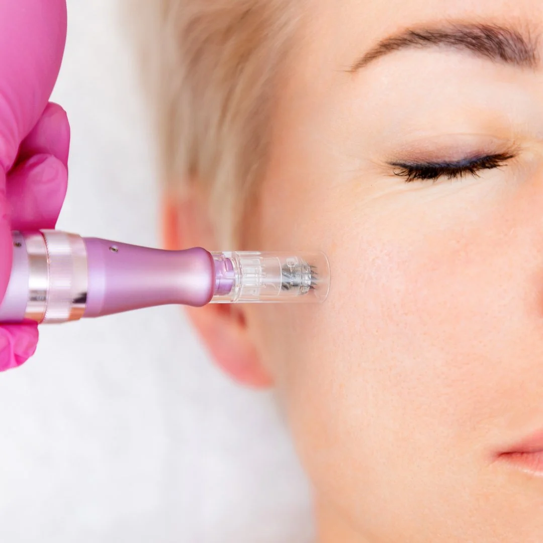 FAQ Microneedling