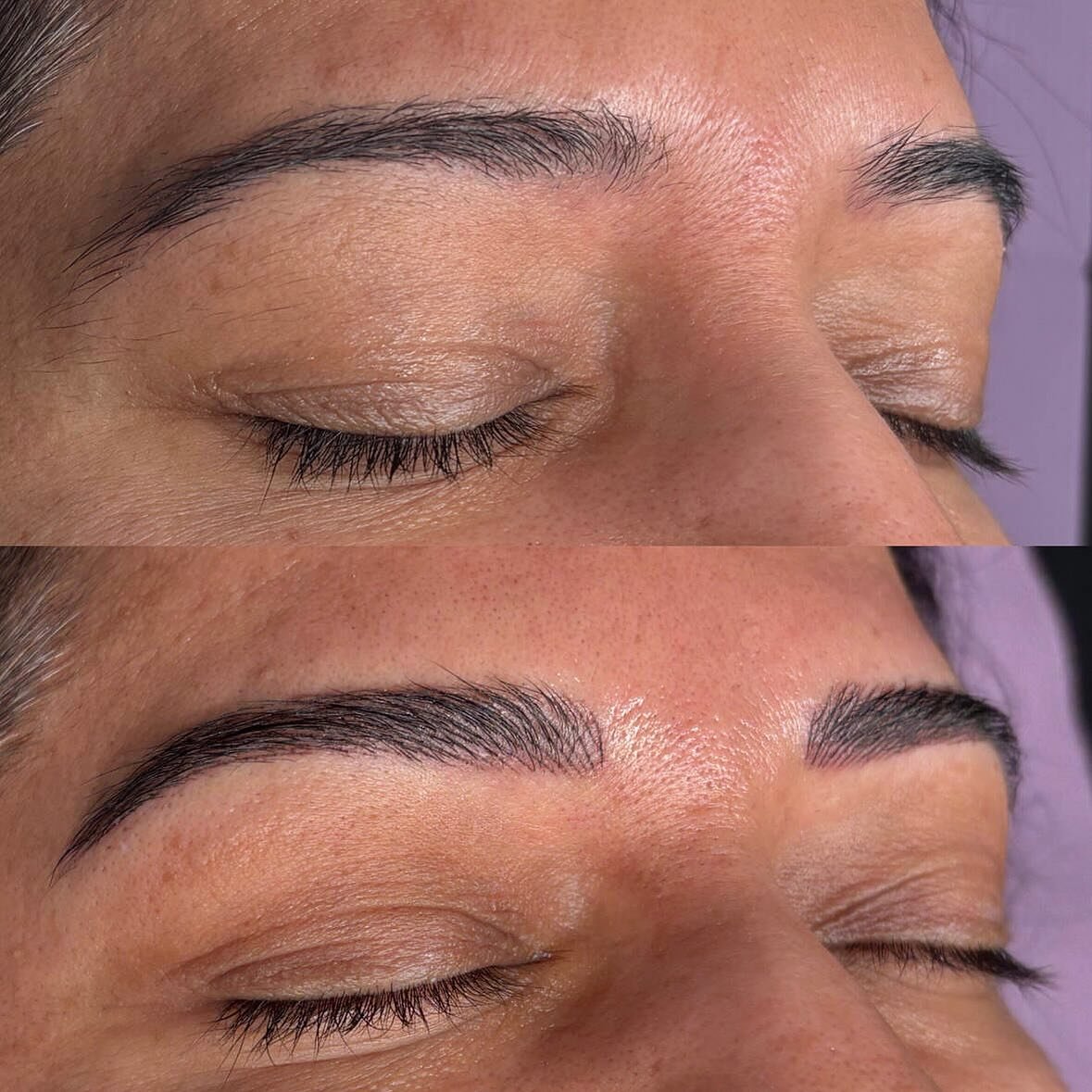 Before ➝ After ✨

These are nano brows (also known as machine hairstrokes). Instead of a manual set of needles used in microblading, a machine and single needle are used to create these individual hair-like strokes.

Why I love offering both techniqu