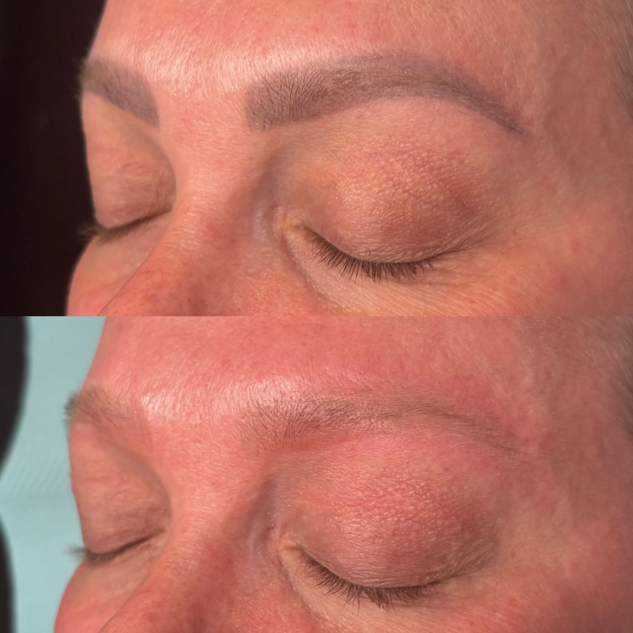 Can Old Brow Tattoos Be Corrected?