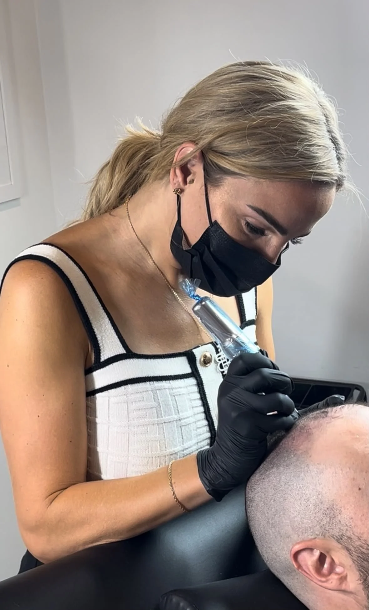 5 Reasons People Choose Scalp Micropigmentation for Hair Loss