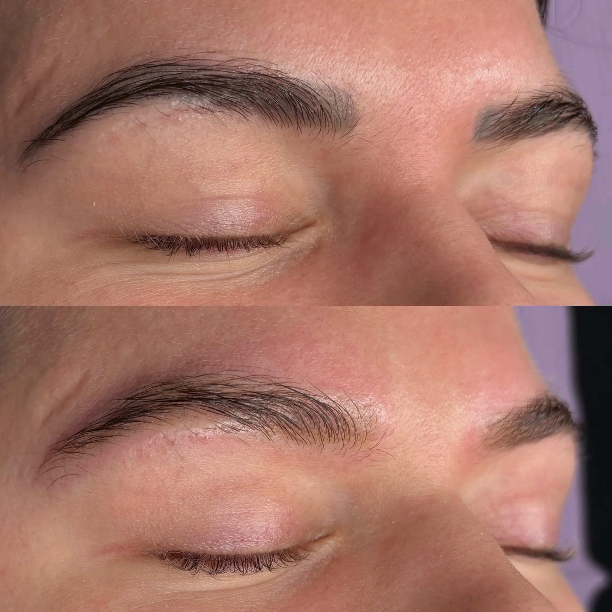 The Truth About Brow Tattoo Removal