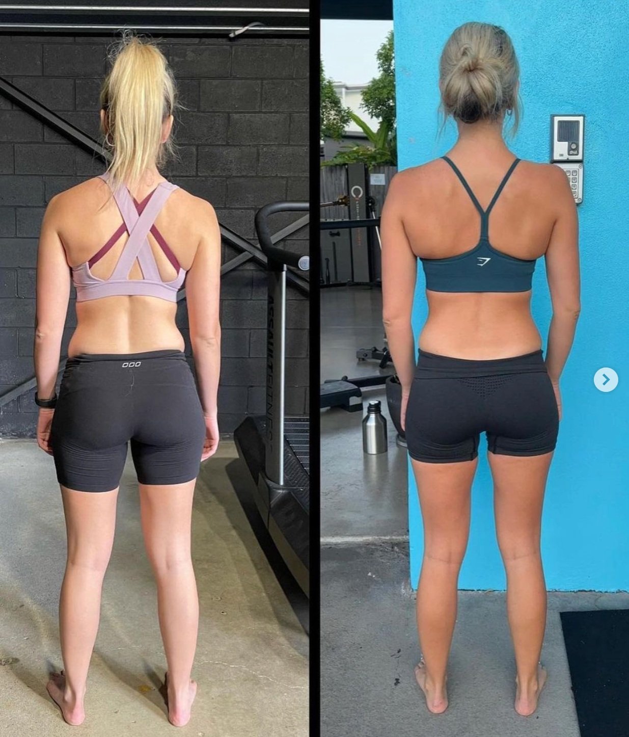 Naturally Straightened Scoliosis