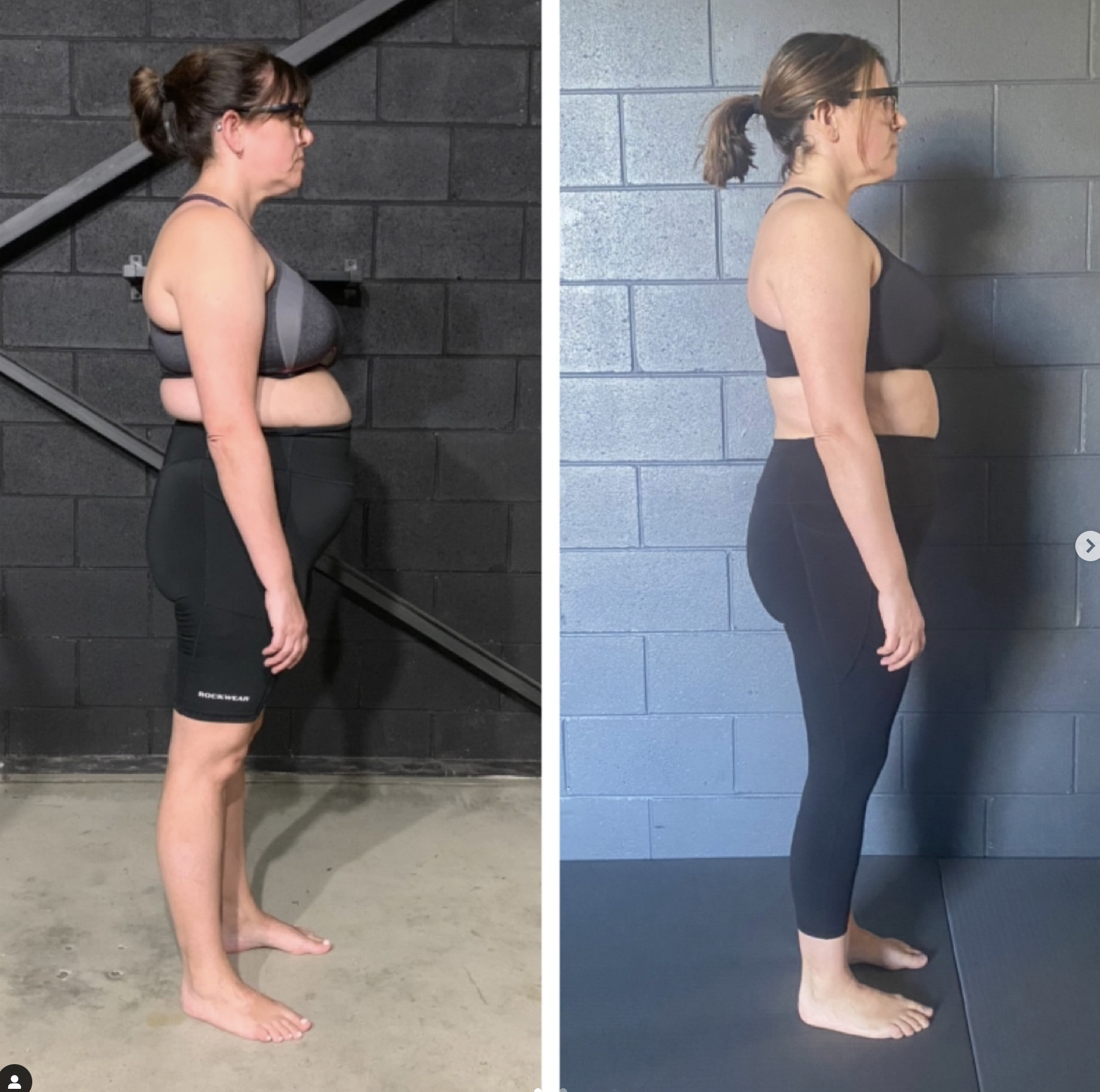 how to fix poor posture