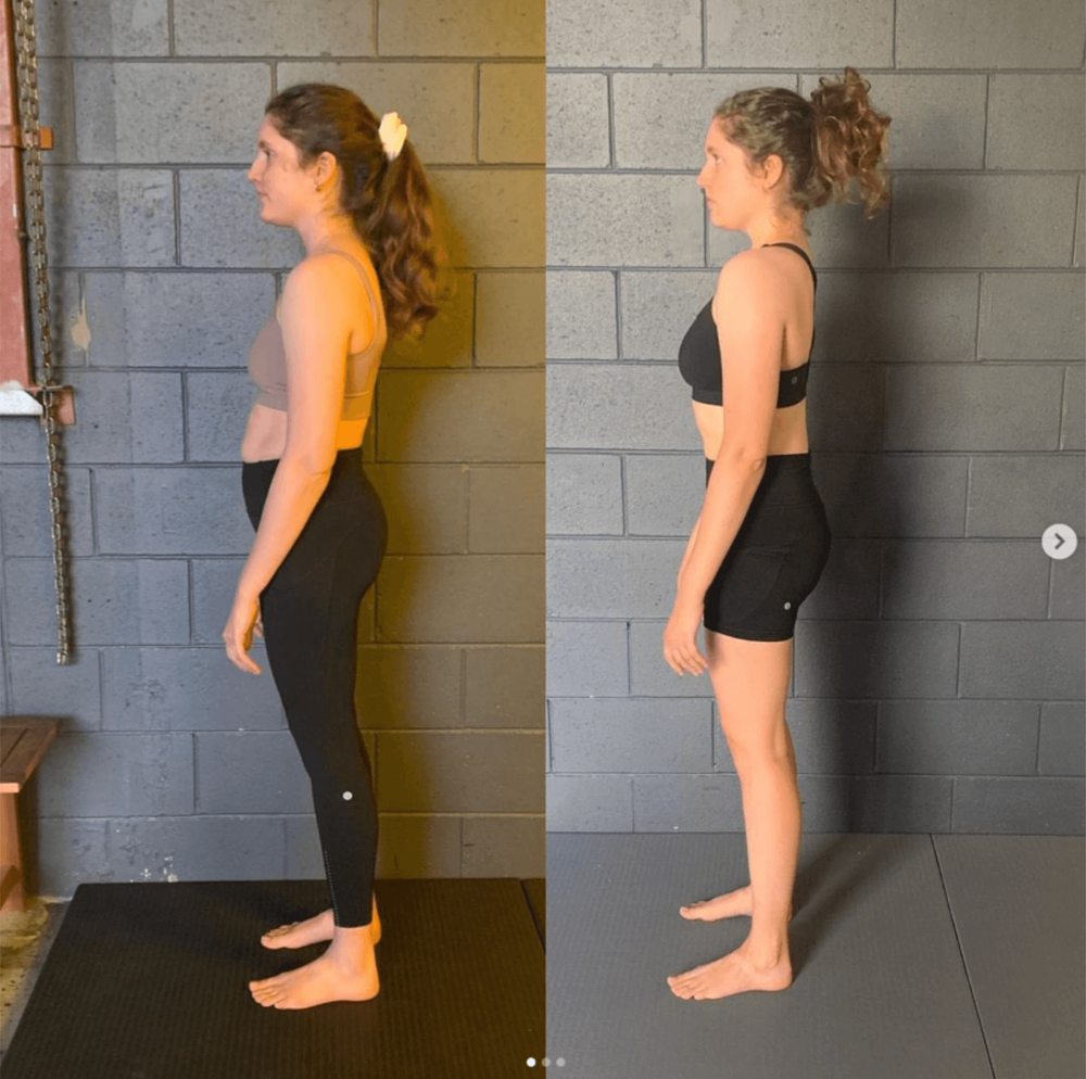 Why Stretching and Strengthening Alone Don’t Fix Pain