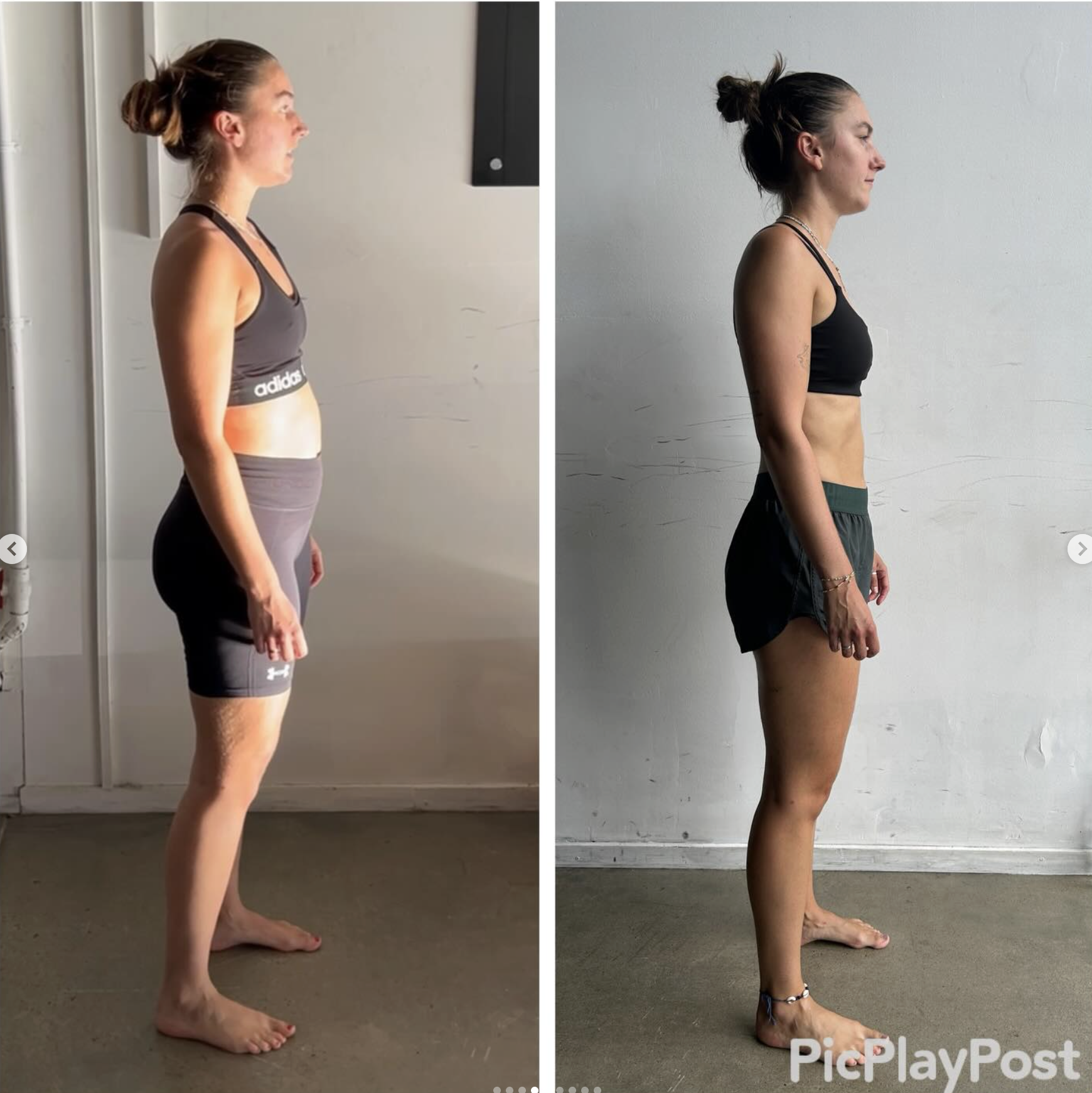 Back Decompression Exercises: What Actually Helps Your Spine