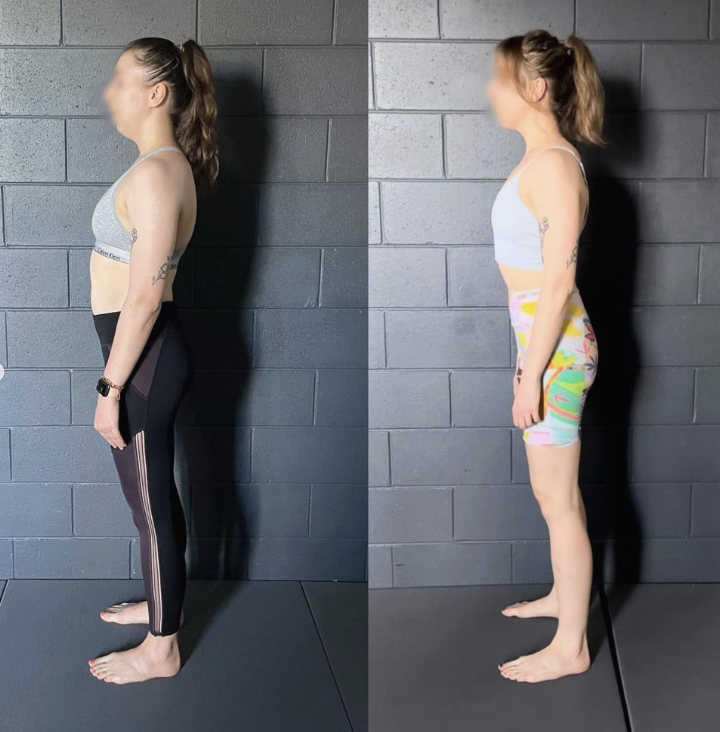 hunchback posture exercises