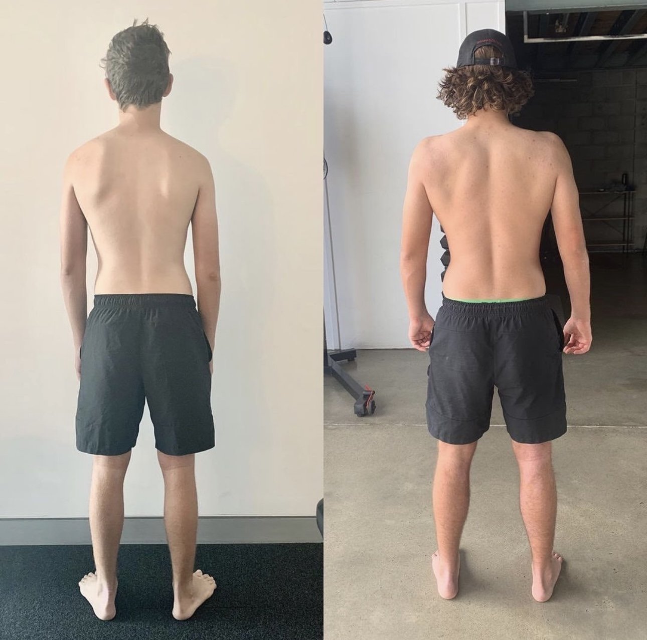 how to increase shoulder ROM