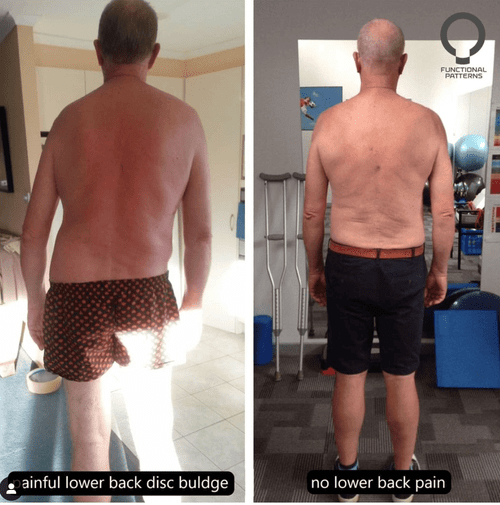 functional patterns before and after