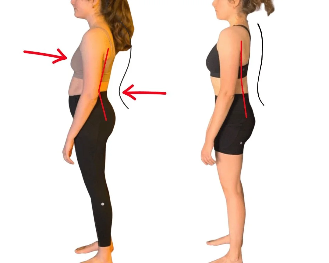 Does 'Pulling Your Shoulder Back' Make Posture Better or Worse ...
