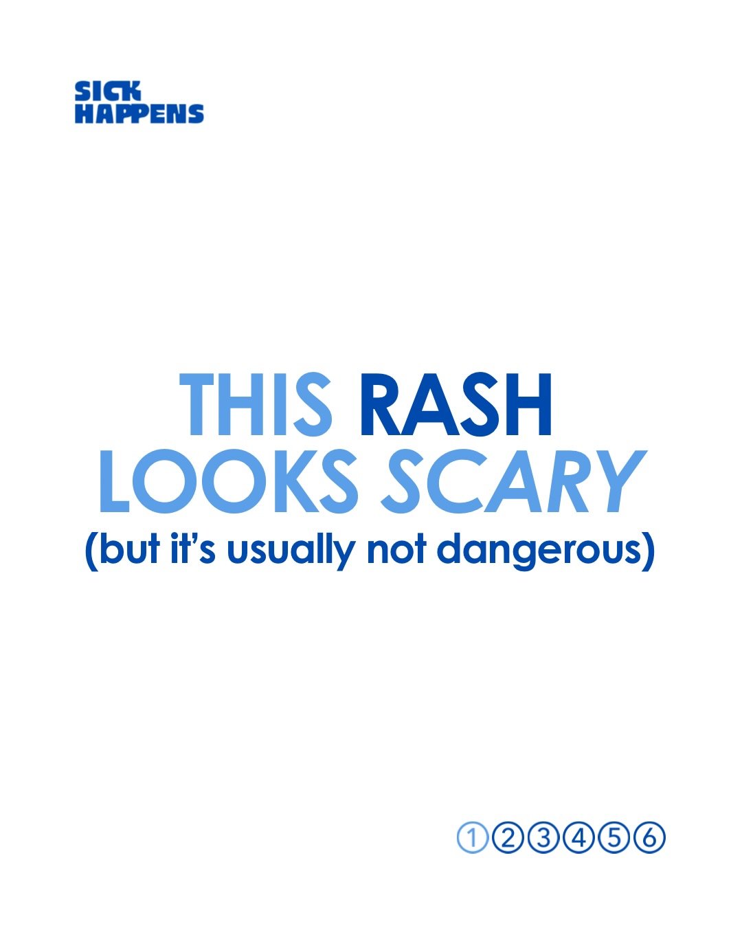This rash can look really alarming.

Especially because it often comes on SUPER quickly, spreads everywhere, makes your child itchy, and then disappears faster than you can say &ldquo;what on earth is this?!&rdquo;

This is urticaria = AKA hives.

It