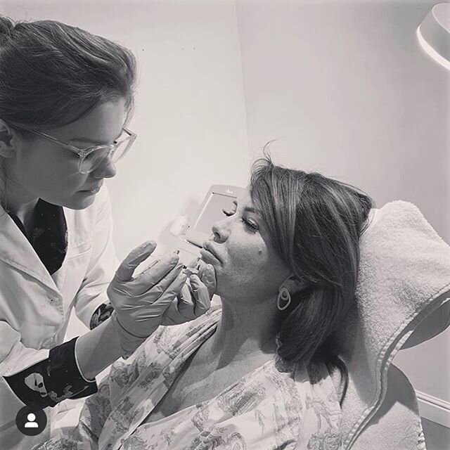 @facefinesse_london at work. #facefinesse is treating this client to smoothen the chin. A great and easy treatment to get rid of some minor indentations of this area. 
Book yours @dameseerst 
Call or use the application
Next clinic 4th of April. 
#ae