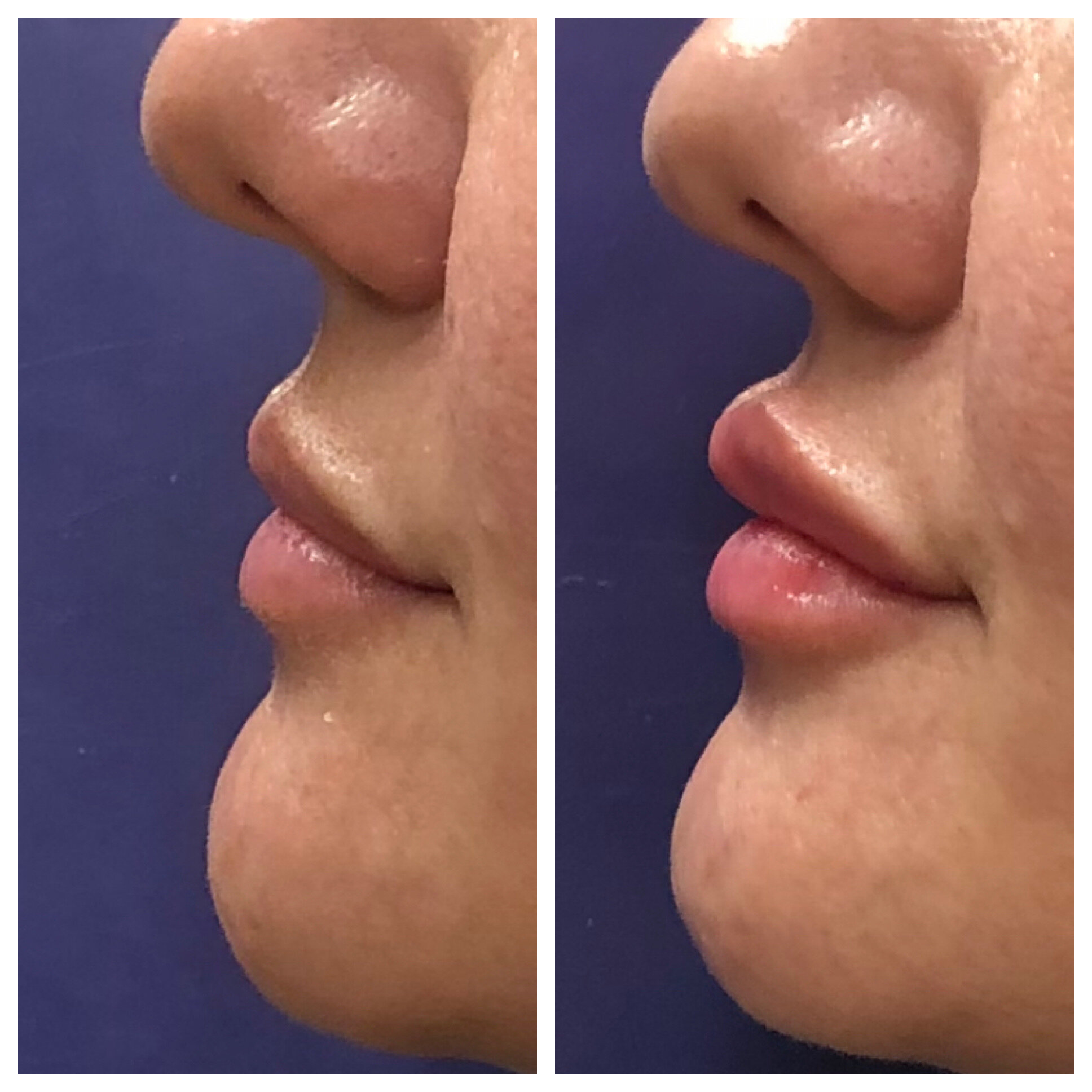 Rosella lips profile.JPG