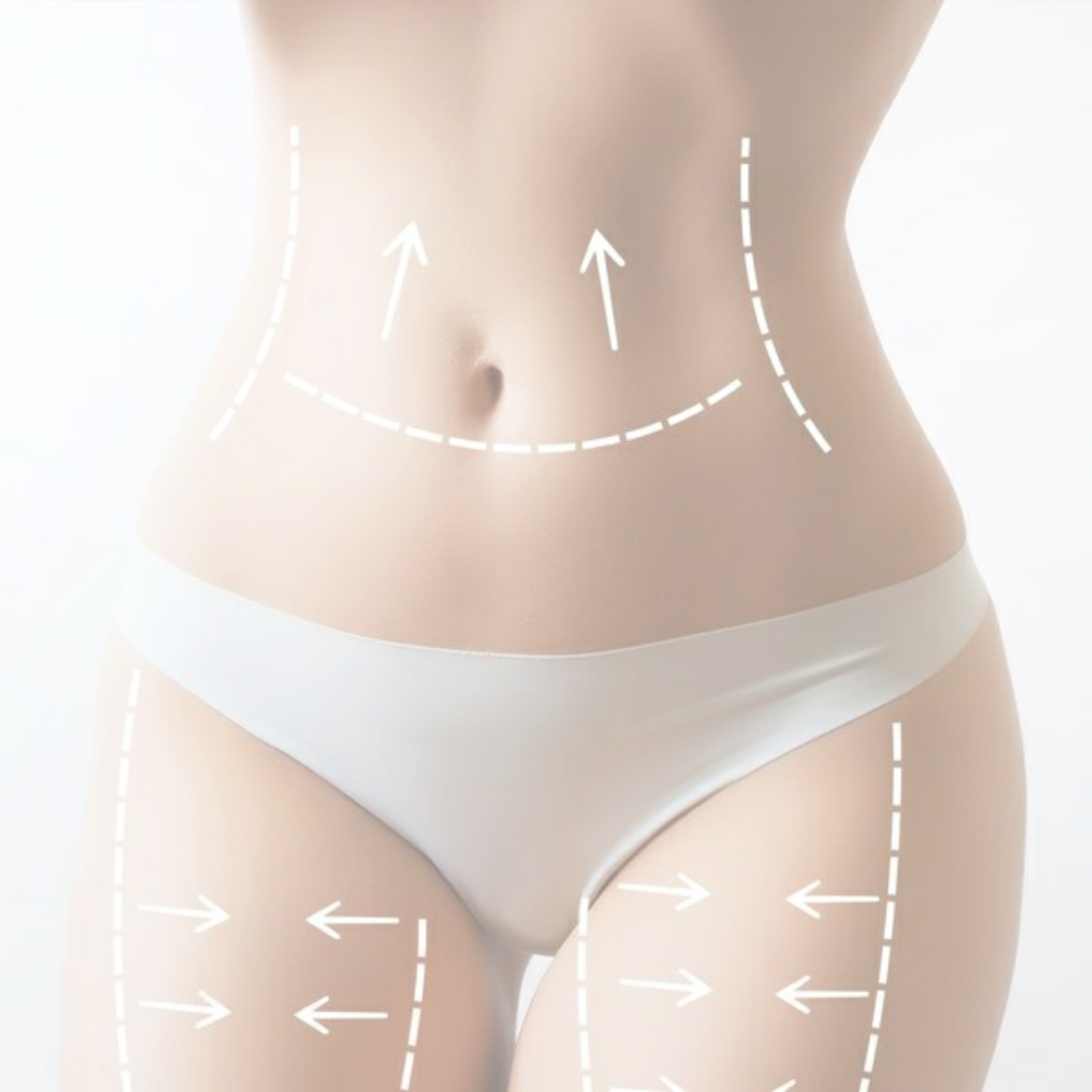 Stretchmark Amanda.jpg