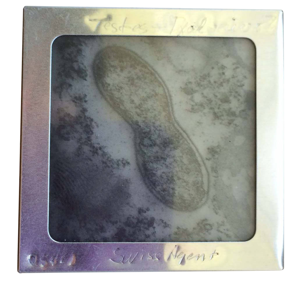 040-Swiss_agent_testes_Ixod_rick_05461__Labeling.png