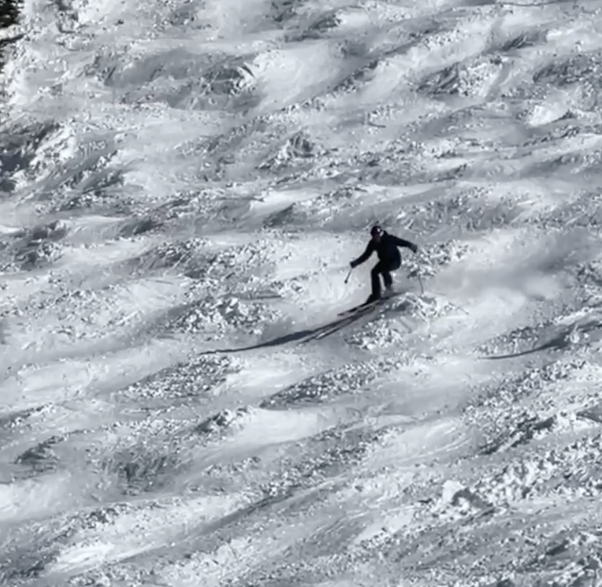I Landed the Jump. My Knee Did Not.