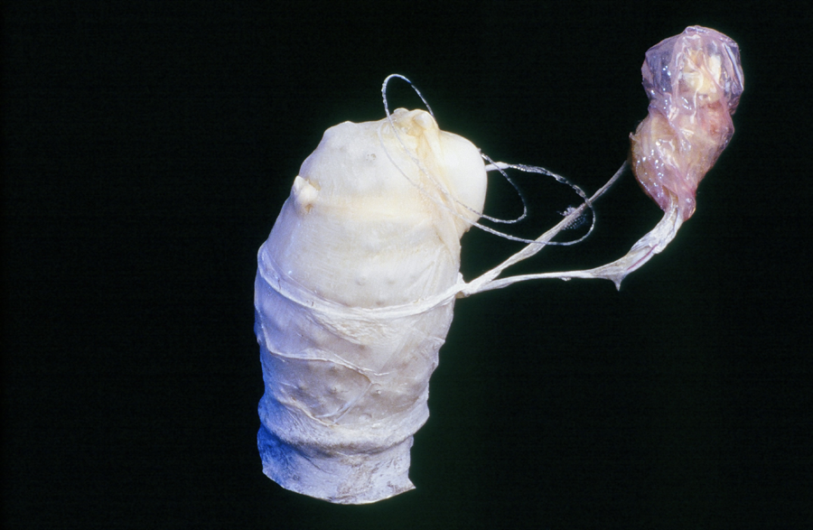 Who Are You? Latex, sausage casings, wire, 7” x 7” 1998