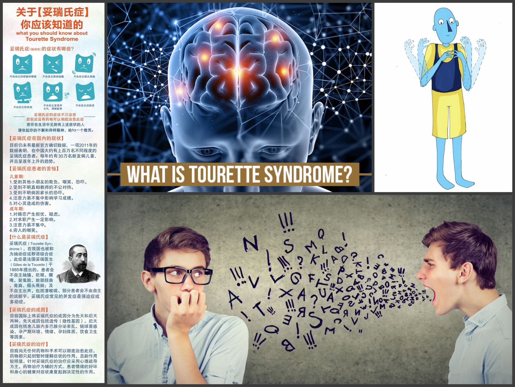 Dajiang: Tourette's is a neurological condition that makes patients have involuntary body movements and vocal tics.
