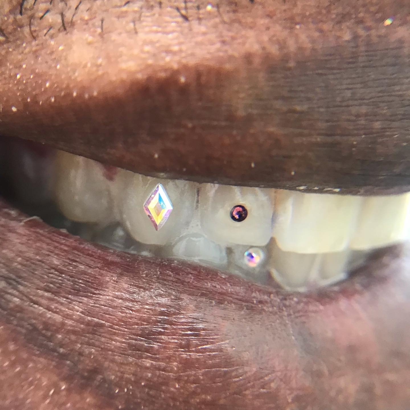 Tooth Gem With Swarovski Crystals Video & Process