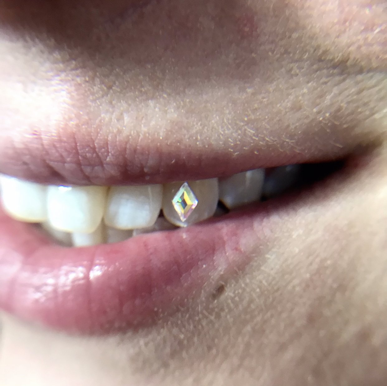Tooth Gems & Glue – EYE DESIGN PROFESSIONAL