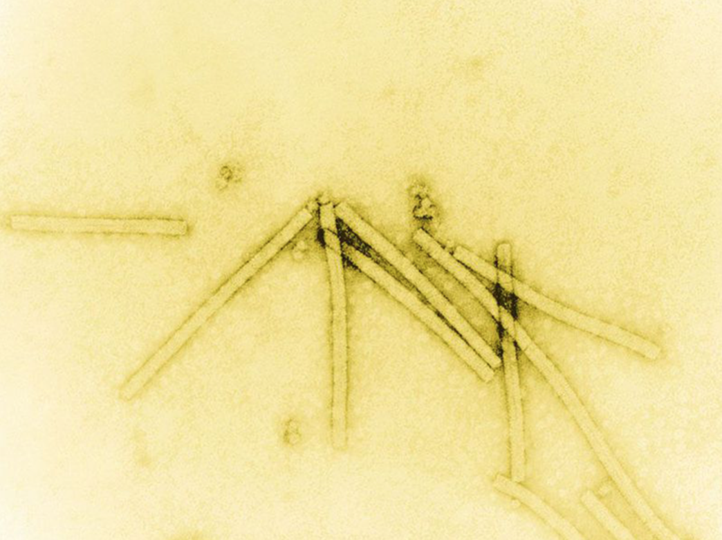 Image of tobacco mosaic virion (virus particle) created by coating virus material with a heavy metal to make structural features visible; magnified 160,000 times with electron microscope (public domain image).