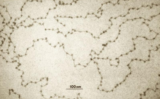 DNA (black “string”) and nucleosomes (“beads” on the string), as imaged by an electron microscope.