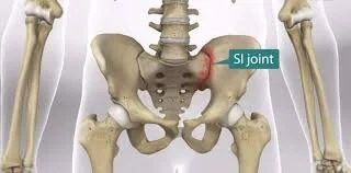 Is It Really Your Low Back Hurting You? A Deeper Look into The SacroIliac Joint That May Be The Culprit