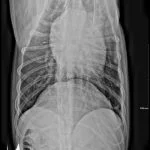 SinXray4-150x150.jpg