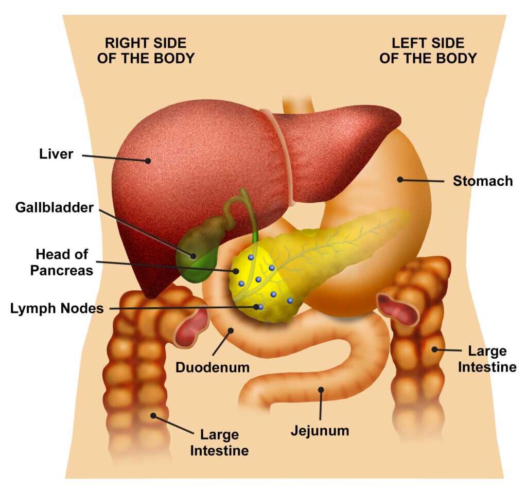 Exocrine Pancreatic Insufficiency When Digestion Fails Hive Mind Medicine Exocrine Pancreatic Insufficiency When Digestion Fails Hive Mind Medicine