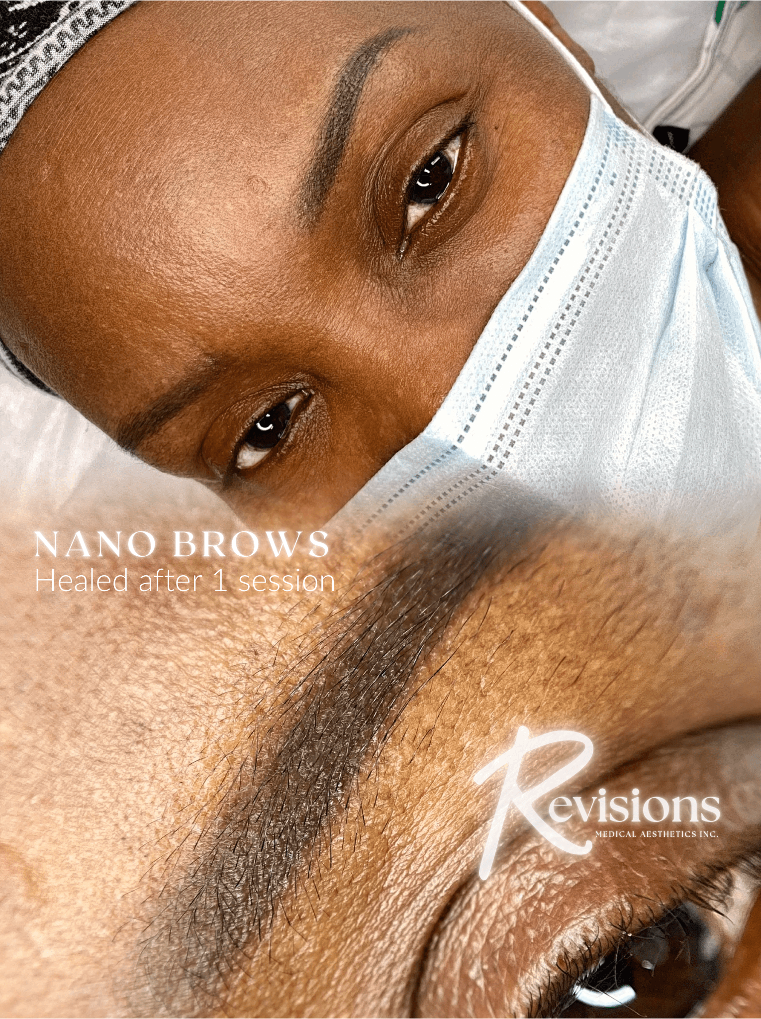 Best Nano Brows and Powder Brows for Dark Skin in Ottawa (1).png