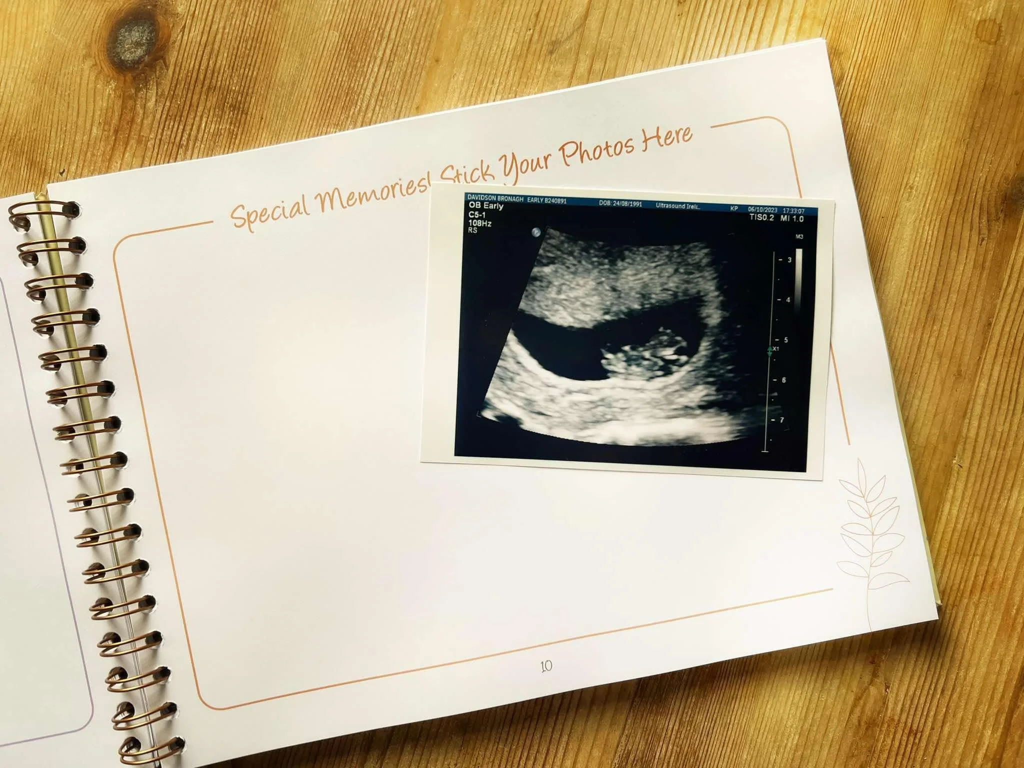 “Pregnancy Journal with space for bump photos and ultrasound scans – unique gift for expecting mums”