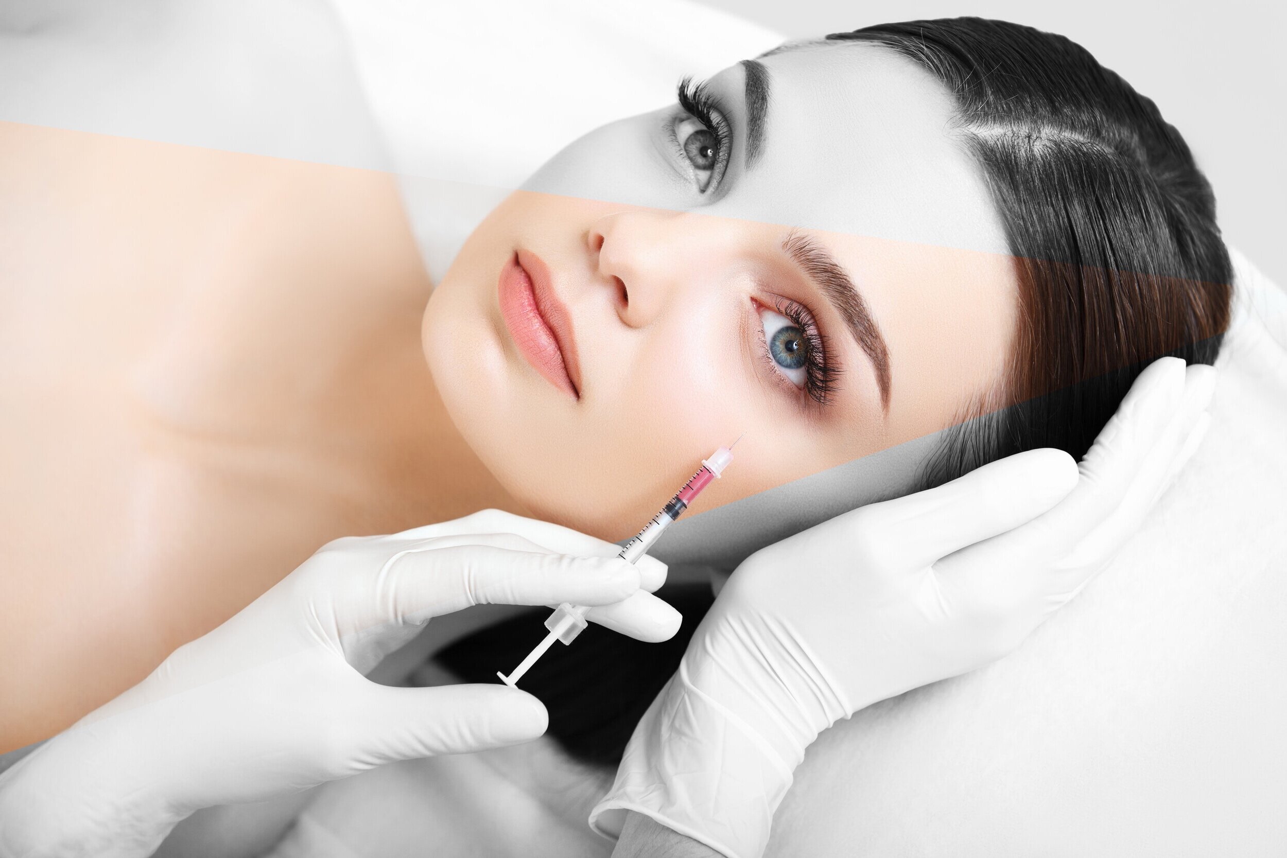 Dermal Fillers — Victoria Sophia Med Spa