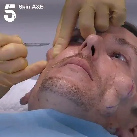 SKIN.jpg