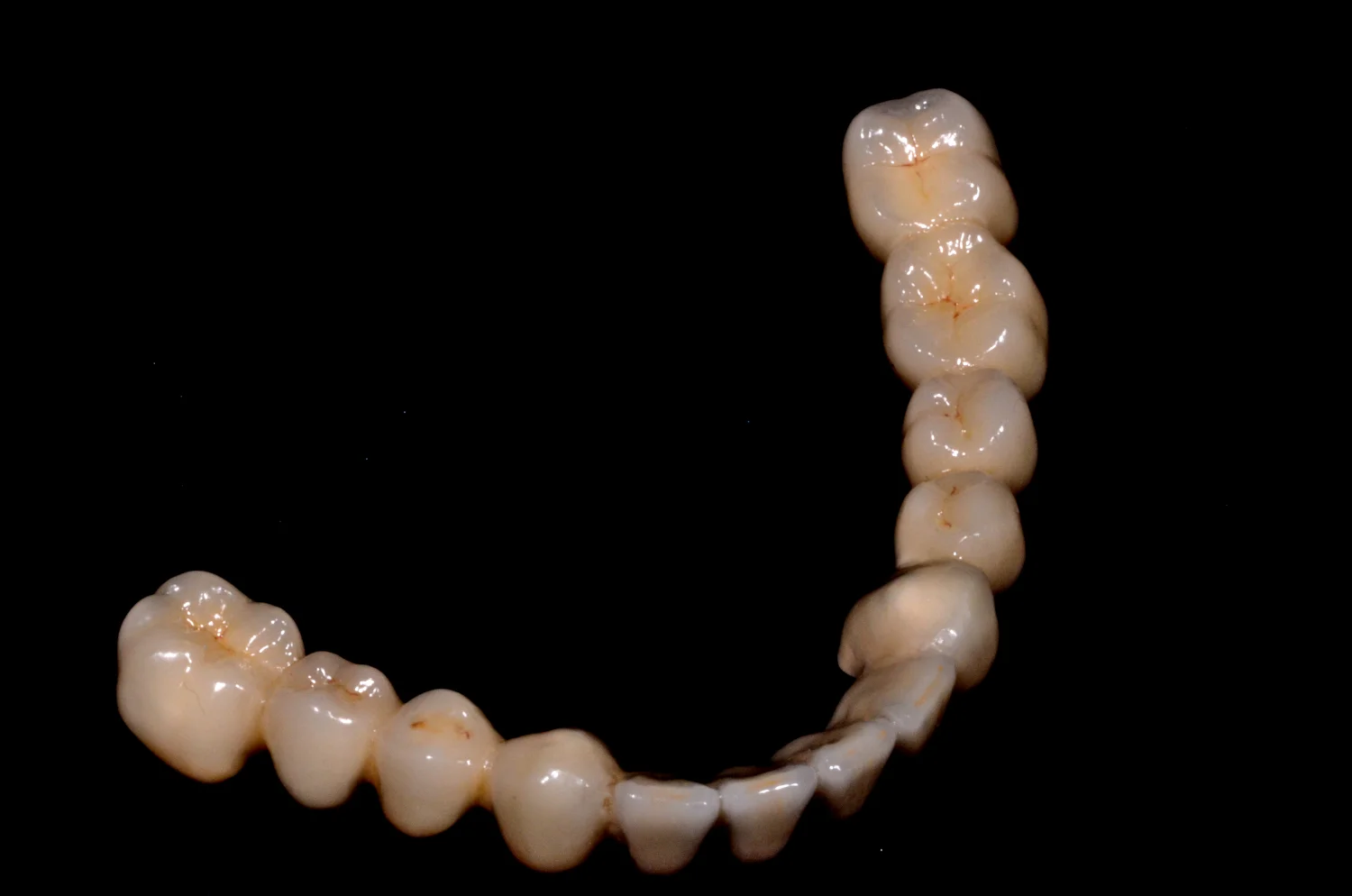 Metalokeramika InLine