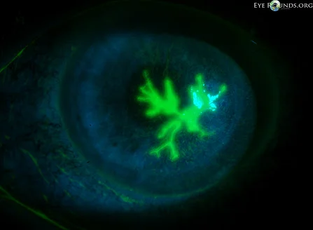 dendrite-1.jpg